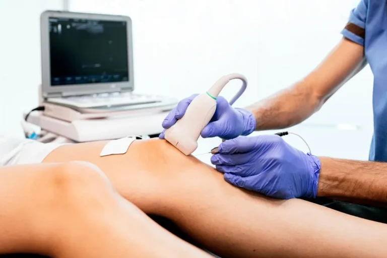 Servicios 3 Ecografía musculoesquelética con ecógrafo en consulta — clínica AlcoFisio Alcobendas